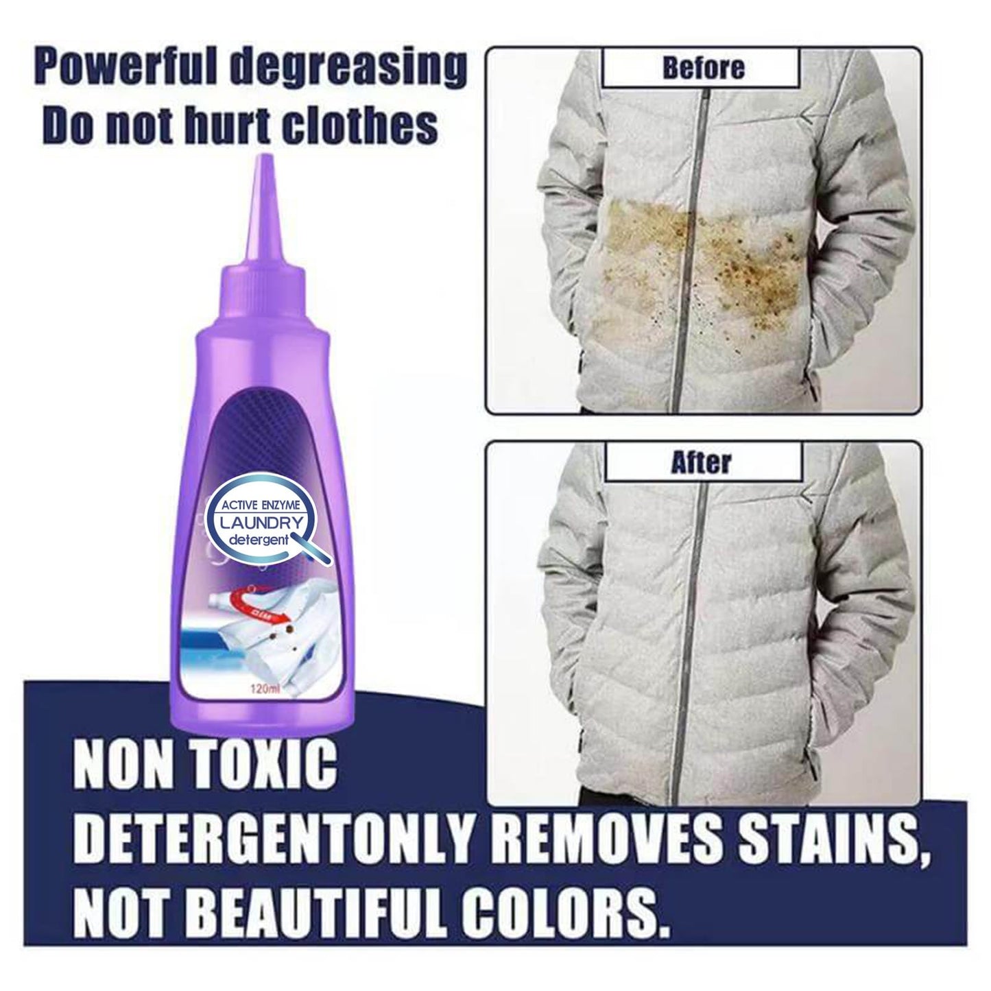 Active Enzyme Laundry Stain Remover - Garment Stubborn Stain Cleaner Oil Remover, Collar Stain Removal Spray (2Pcs)