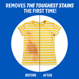 OxiClean Verstaile Stain Remover for Household and Laundry - 64 Loads (for All Machines Including He)