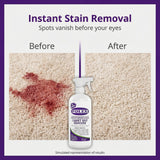 FOLEX - Professional Carpet Cleaner Spray 34 oz - Pet Stain Removal - Instant Stain Removal - No Rinsing Required - Safe for Pets - Works on All