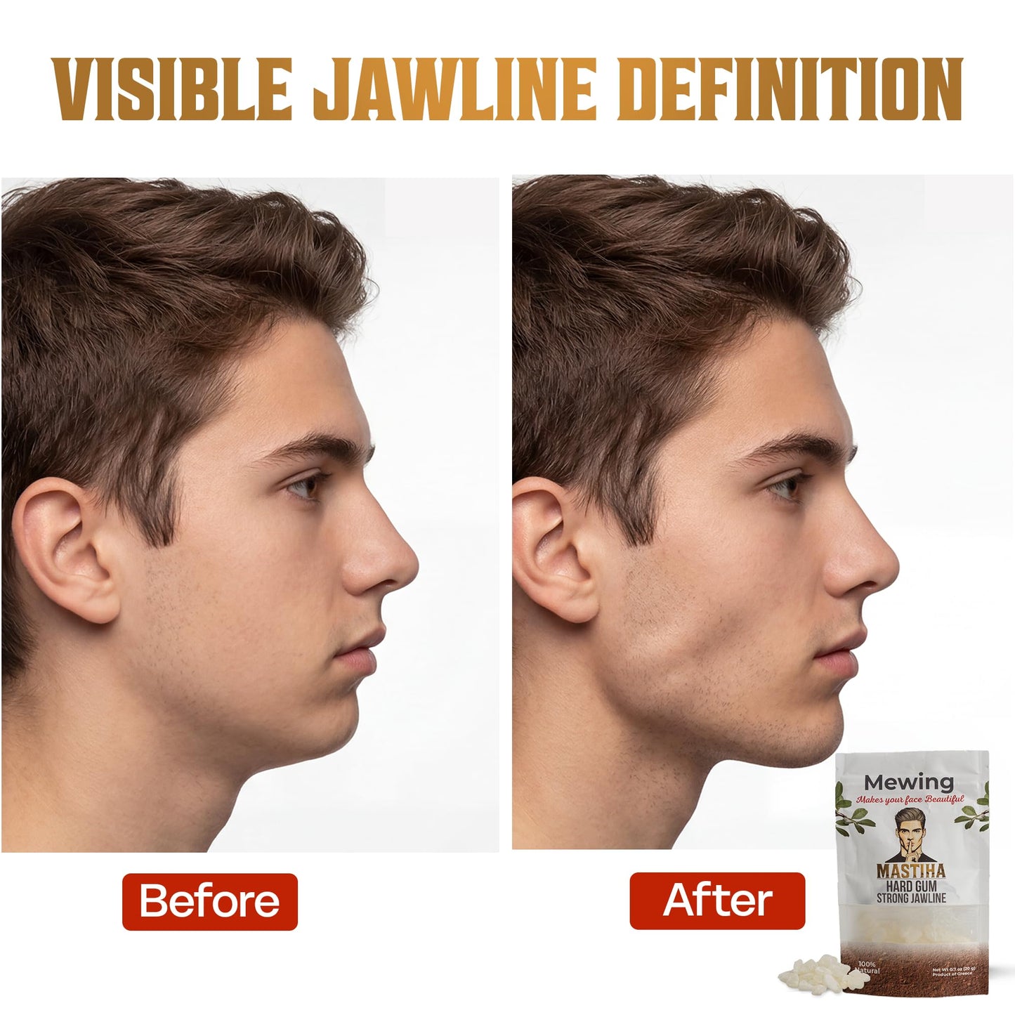 Mastic Gum for Jawline Training - 100% Natural Chios Mastiha Hard Chewing Gum | 20 Servings, 1g Each | Ultra-Tough Mewing Gum for Men | Jawline